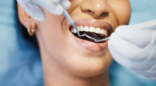 Best Emergency Dental Services for Seniors in Missoula, MT